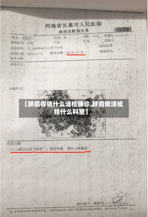 【肺癌得做什么活检确诊,肺癌做活检挂什么科室】