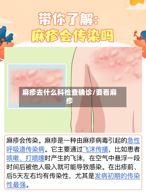 麻疹去什么科检查确诊/要看麻疹