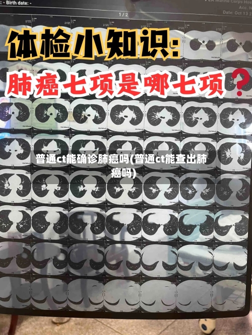 普通ct能确诊肺癌吗(普通ct能查出肺癌吗)