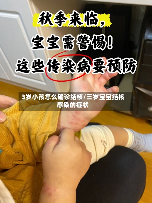 3岁小孩怎么确诊结核/三岁宝宝结核感染的症状-第2张图片