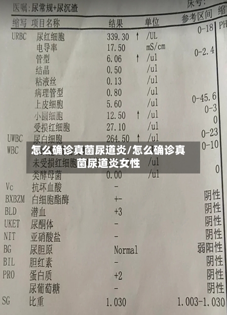 怎么确诊真菌尿道炎/怎么确诊真菌尿道炎女性-第2张图片