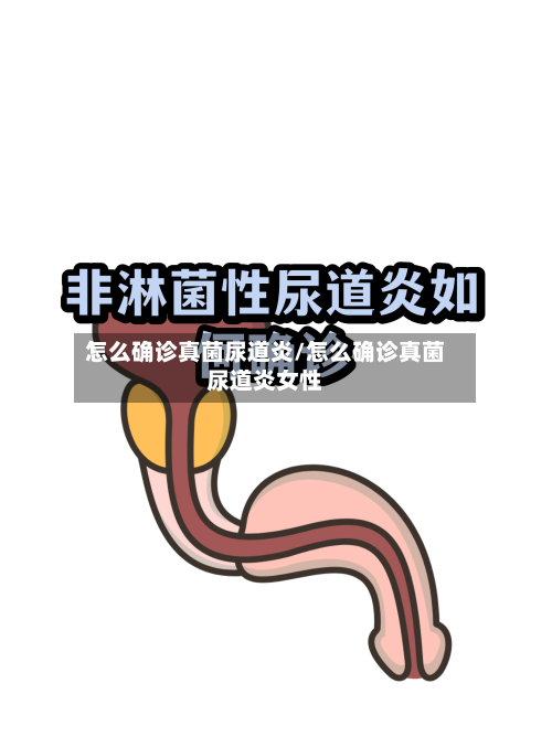 怎么确诊真菌尿道炎/怎么确诊真菌尿道炎女性