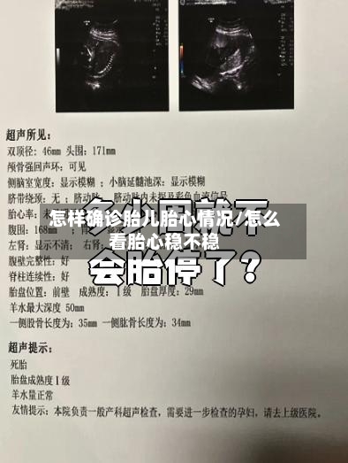 怎样确诊胎儿胎心情况/怎么看胎心稳不稳