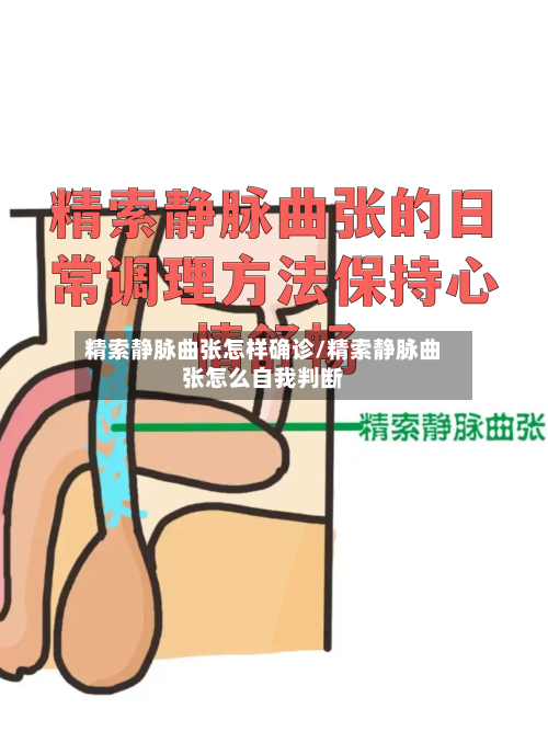 精索静脉曲张怎样确诊/精索静脉曲张怎么自我判断-第3张图片