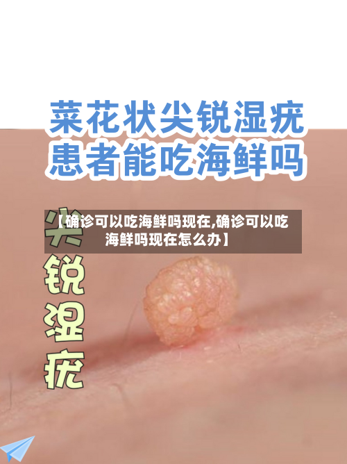 【确诊可以吃海鲜吗现在,确诊可以吃海鲜吗现在怎么办】