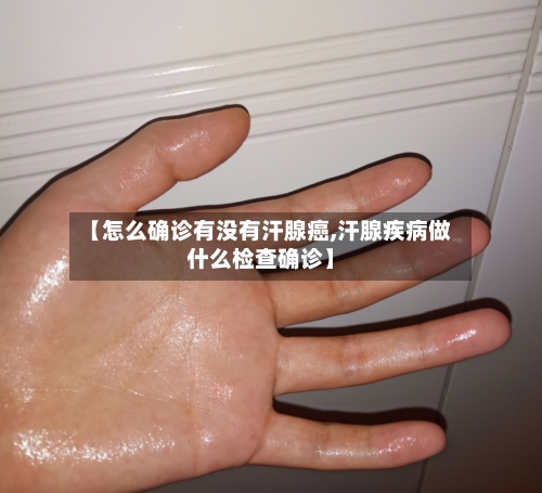 【怎么确诊有没有汗腺癌,汗腺疾病做什么检查确诊】-第2张图片