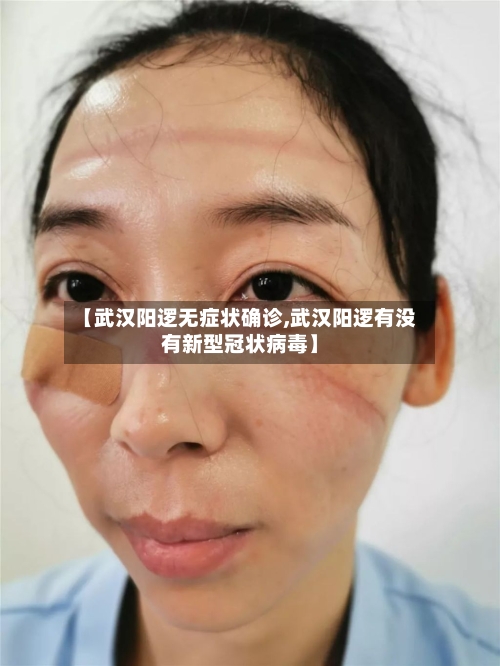 【武汉阳逻无症状确诊,武汉阳逻有没有新型冠状病毒】
