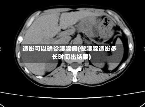 造影可以确诊胰腺癌(做胰腺造影多长时间出结果)-第2张图片