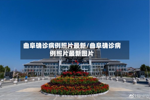 曲阜确诊病例照片最新/曲阜确诊病例照片最新图片-第2张图片