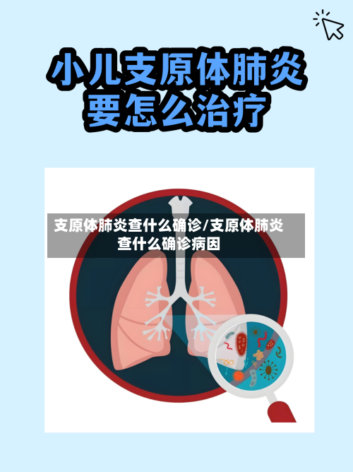 支原体肺炎查什么确诊/支原体肺炎查什么确诊病因