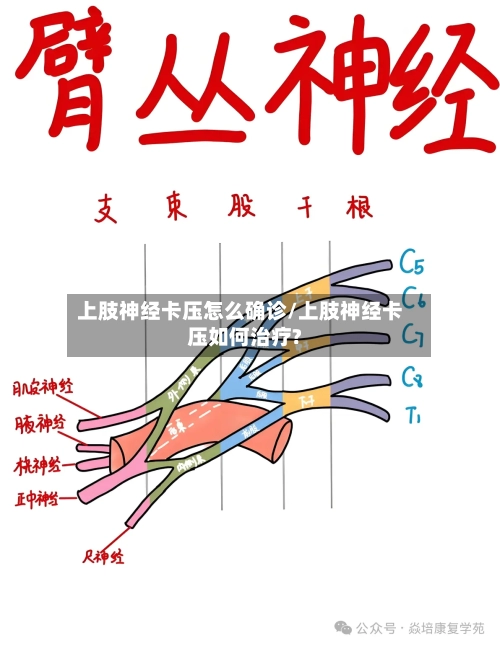 上肢神经卡压怎么确诊/上肢神经卡压如何治疗?-第2张图片