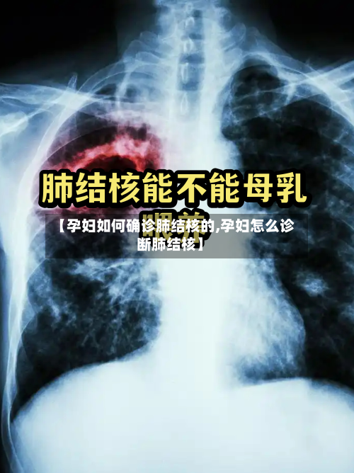 【孕妇如何确诊肺结核的,孕妇怎么诊断肺结核】