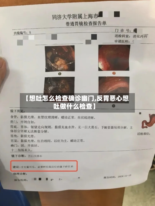 【想吐怎么检查确诊幽门,反胃恶心想吐做什么检查】