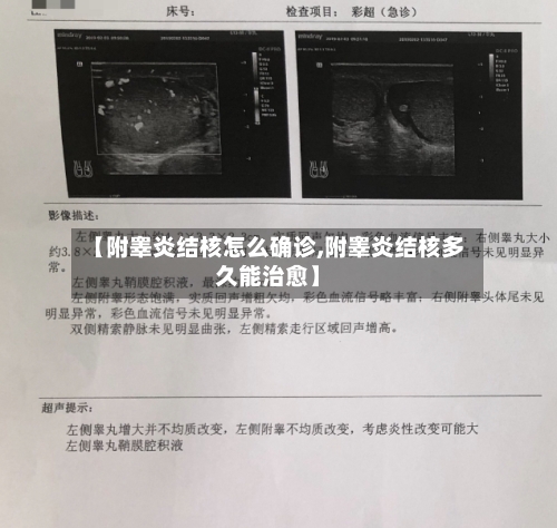【附睾炎结核怎么确诊,附睾炎结核多久能治愈】-第3张图片