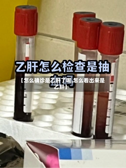 【怎么确诊是乙肝了呢,怎么看出来是乙肝】-第2张图片
