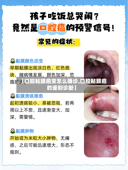 【口腔粘膜癌变怎么确诊,口腔粘膜癌的鉴别诊断】