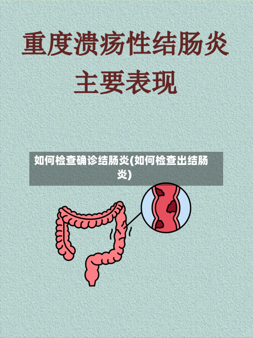 如何检查确诊结肠炎(如何检查出结肠炎)